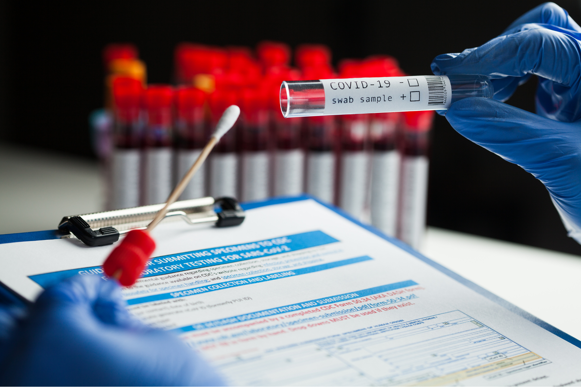 PCR Test Sonucu Tercümesi Nedir? Yurt Dışı Seyahat ve Sağlık Başvuruları İçin Gerekli mi?